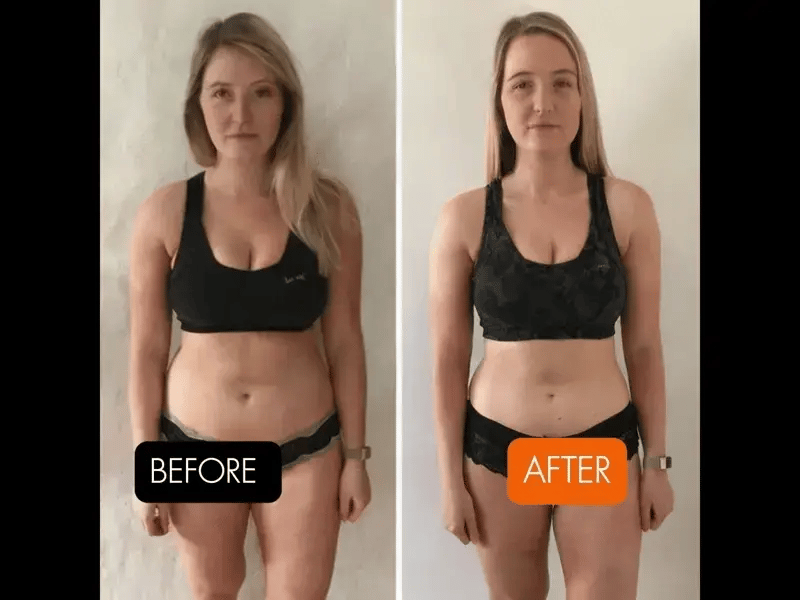 ImpulseX Muscle Stimulator Set